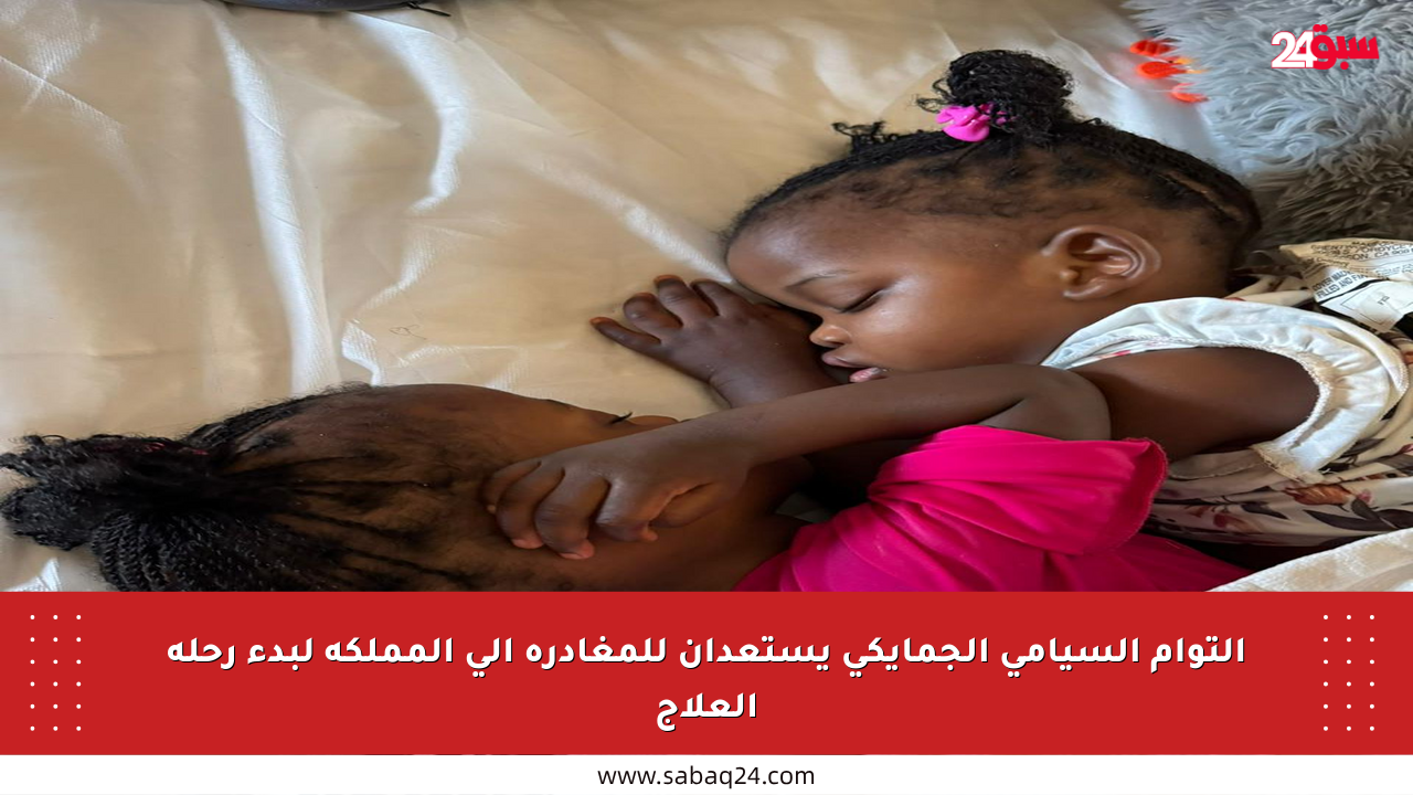 التوأم السيامي الجمايكي يستعدان للمغادرة إلى المملكة لبدء رحلة العلاج